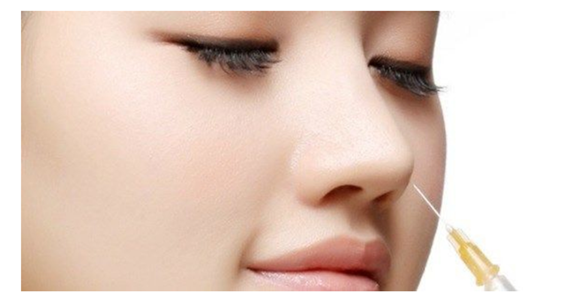 Các phương pháp phẫu thuật mũi