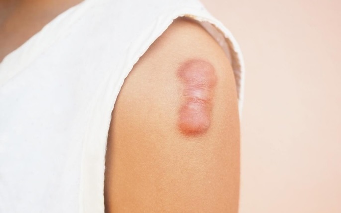 dieu-tri-seo-loi-co-nguy-hiem-khong-1