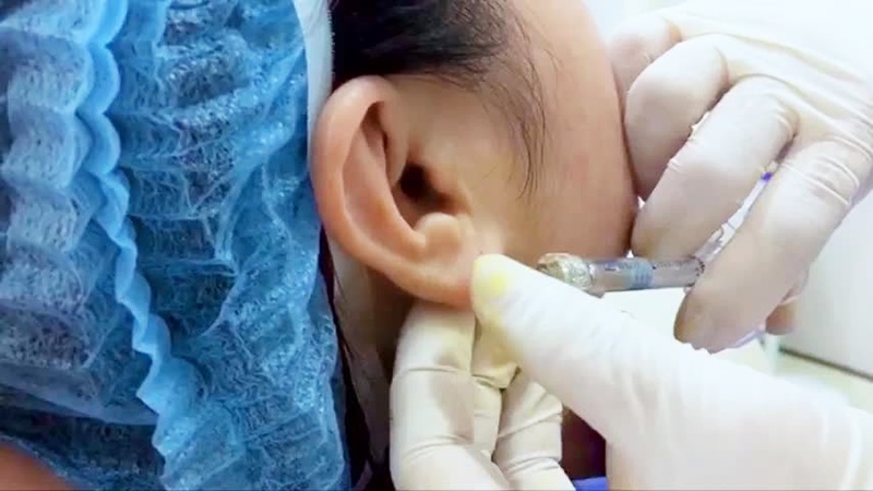 tao-hinh-rach-dai-tai-nhu-the-nao-3