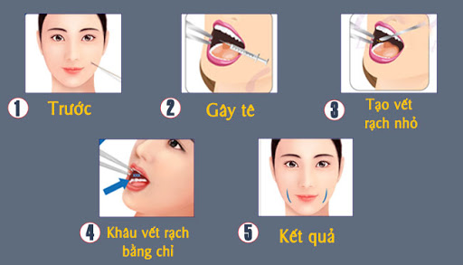 tao-ma-lum-dong-tien-mat-bao-lau-thi-ma-lum-vao-form-tu-nhien-1