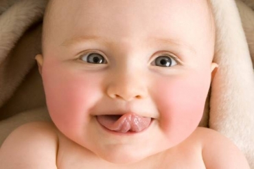 Trị sứt môi ở trẻ nhỏ giá bao nhiêu