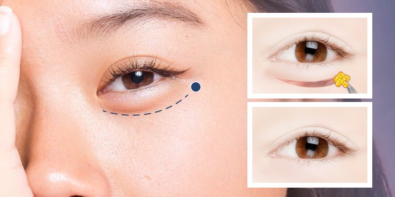 cat-da-thua-mi-duoi-co-dau-khong-2