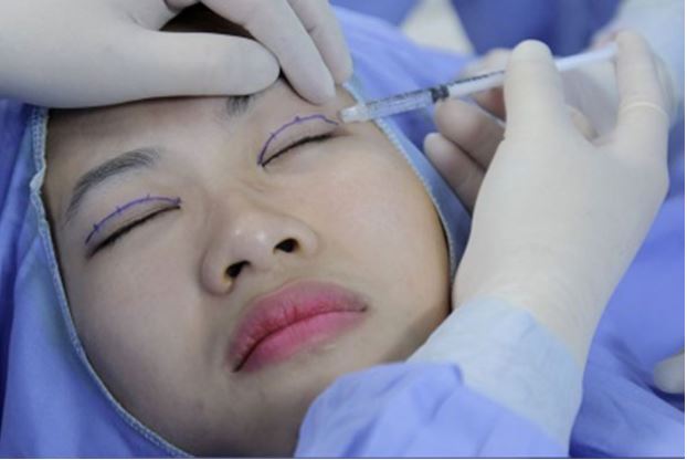 cat-mi-mat-tren-o-dau-dep-3