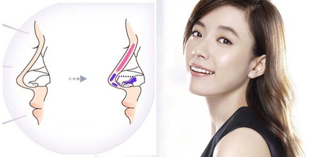 nang-mui-boc-sun-co-nguy-hiem-khong-1