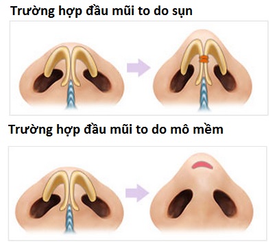 thu-nho-dau-mui-co-de-lai-seo-khong-1