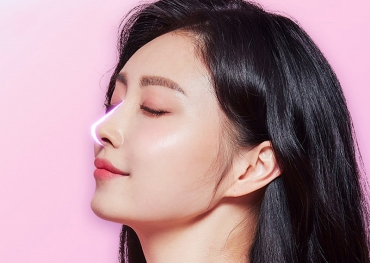 Nâng mũi cấu trúc những điều cần biết