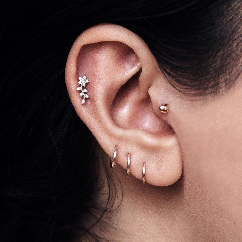 khi-nao-can-phau-thuat-seo-loi-dai-tai-1