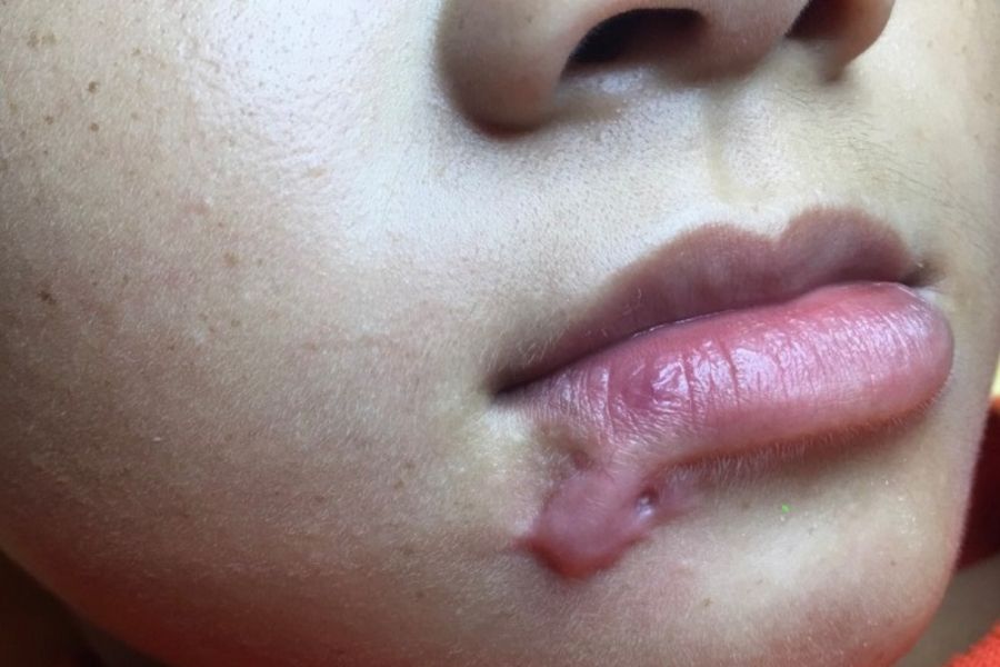 xoa-seo-moi-o-dau-uy-tin-2