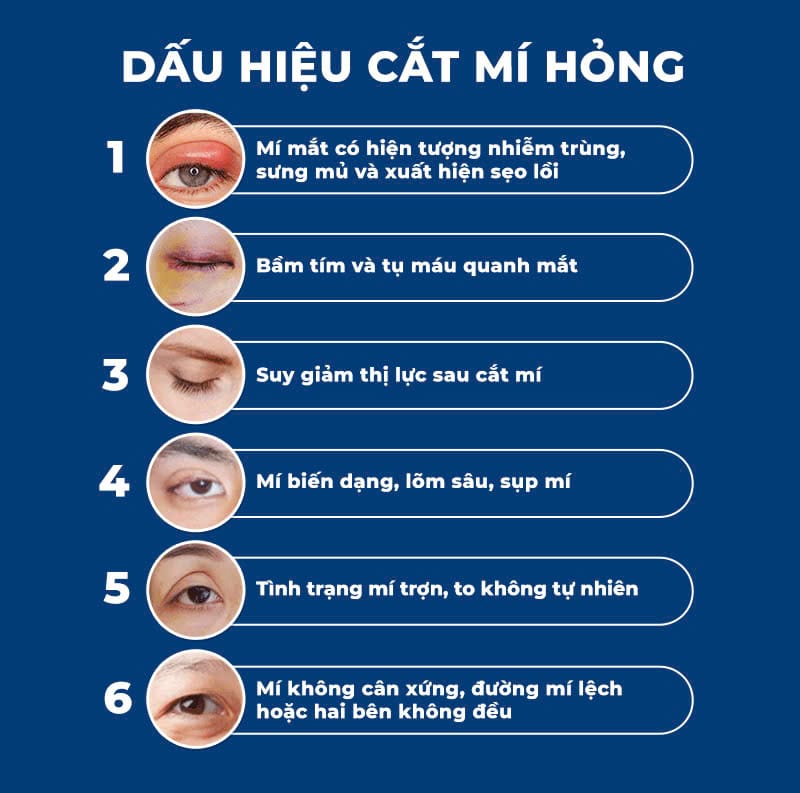 cat-mi-mat-hong-nguyen-nhan-va-cach-khac-phuc-2