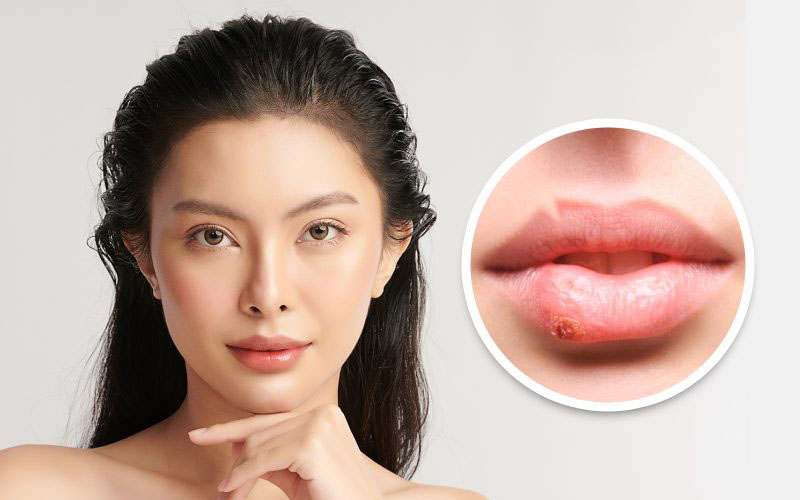 tieu-chi-lua-chon-bac-si-xoa-seo-moi-dep-1