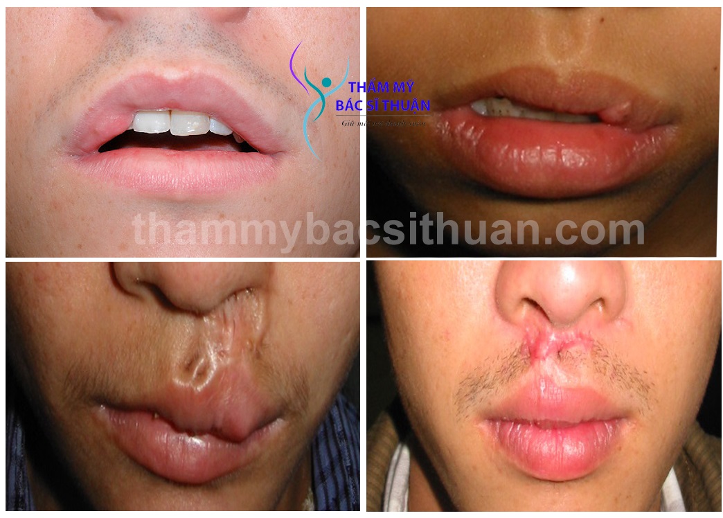 xoa-seo-moi-co-nguy-hiem-khong-1