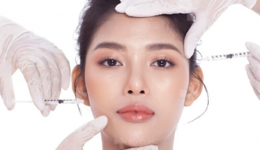 Tiêm filler có tác dụng phụ không