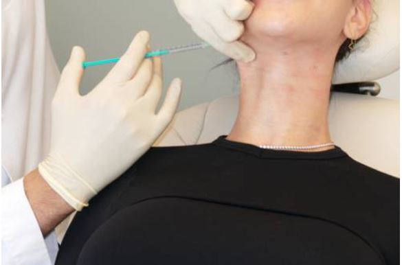 botox-co-xoa-nep-nhan-co-duoc-khong-3