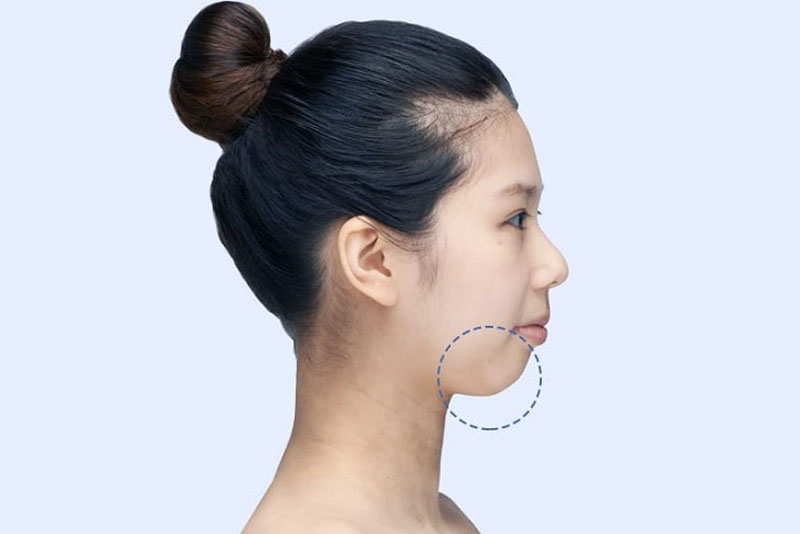 dau-hieu-nhan-biet-cam-lem-va-cach-khac-phuc-1