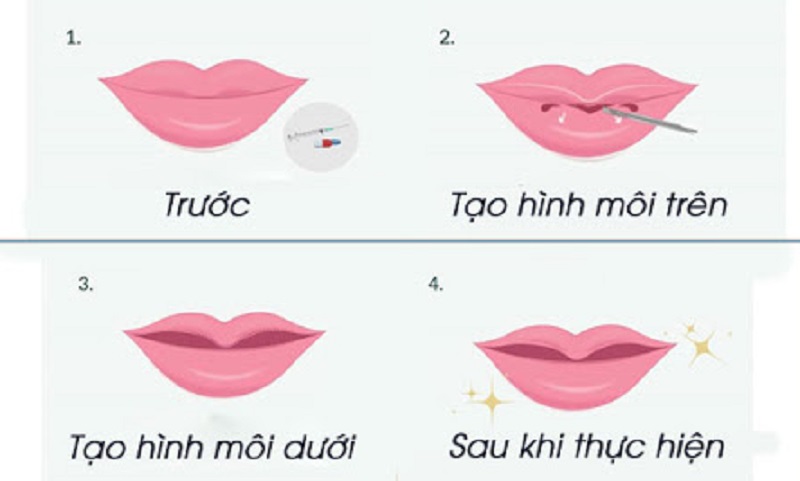 tiem-moi-trai-tim-sao-cho-dep-va-tu-nhien-3