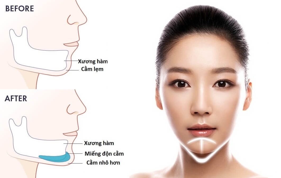 7-ngay-sau-don-cam-nen-kieng-gi-1