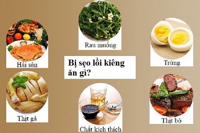 tri-seo-loi-can-kieng-nhung-gi-2