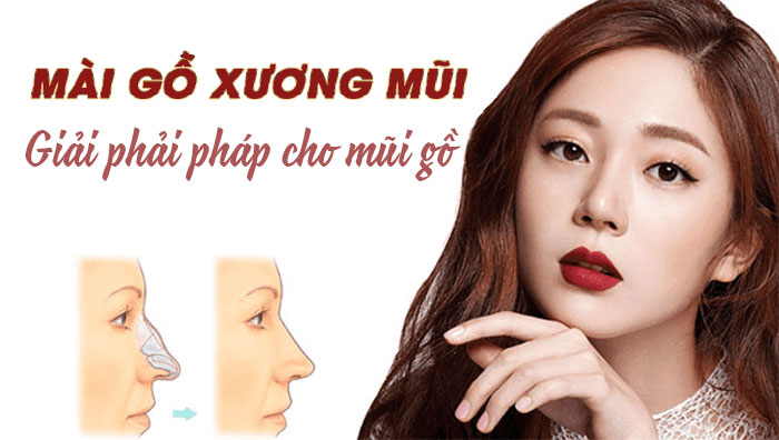 mui-go-la-gi-cach-khac-phuc-mui-go-2