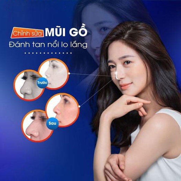 mui-go-la-gi-cach-khac-phuc-mui-go-3