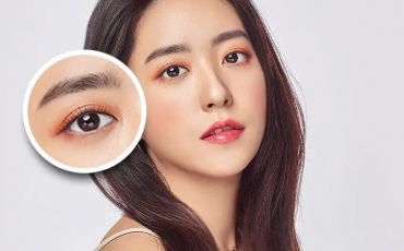 Cắt mí hỏng bao lâu sửa lại được