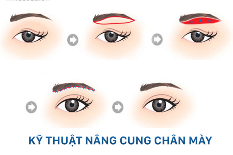 treo-chan-may-can-kieng-nhung-gi-1