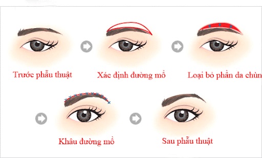 treo-chan-may-va-nhung-dieu-can-biet-1