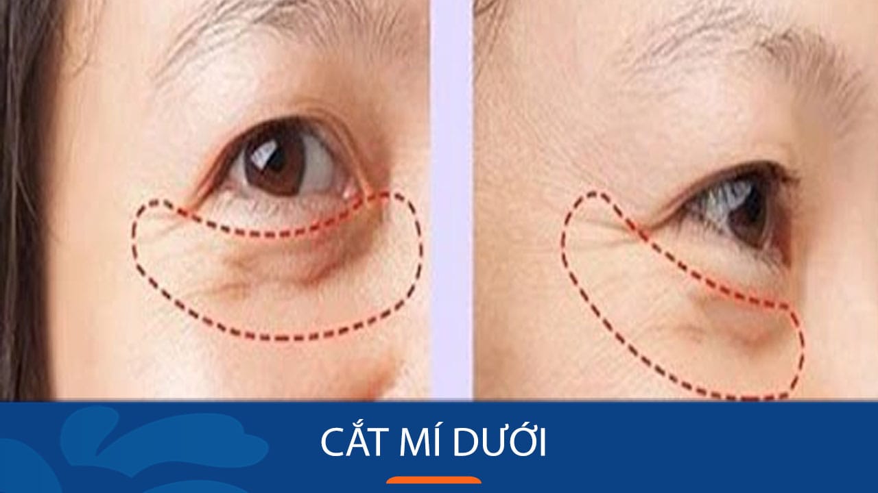 cat-mi-mat-duoi-co-het-tham-khong-2