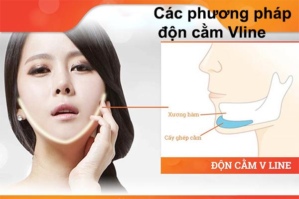 don-cam-co-pha-tuong-khong-2