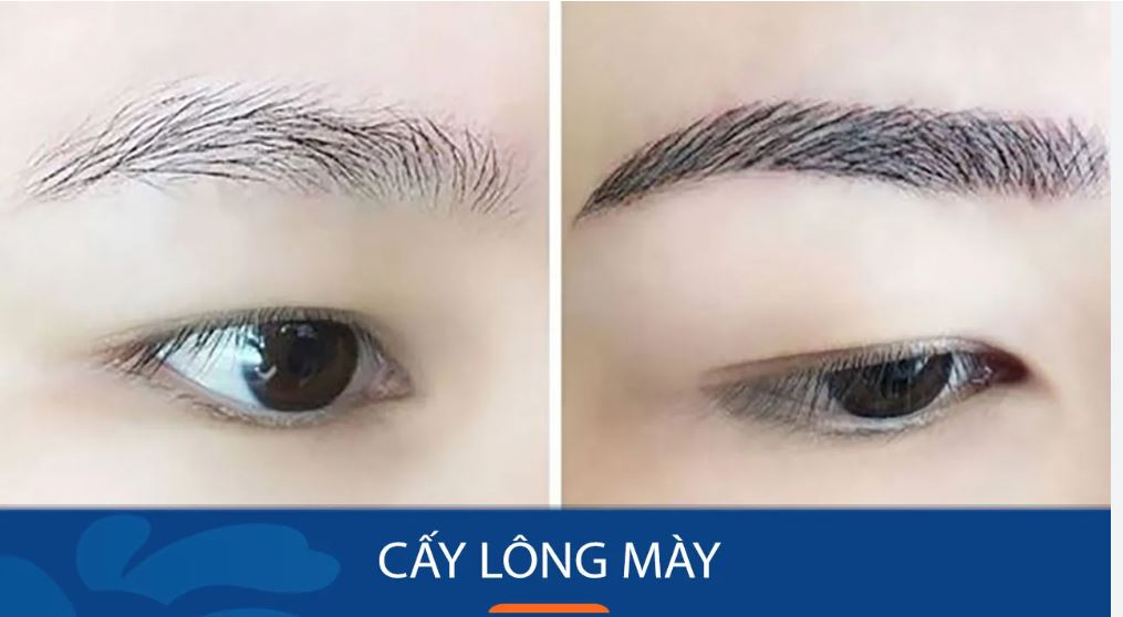 cay-long-may-tu-than-co-ben-khong-2