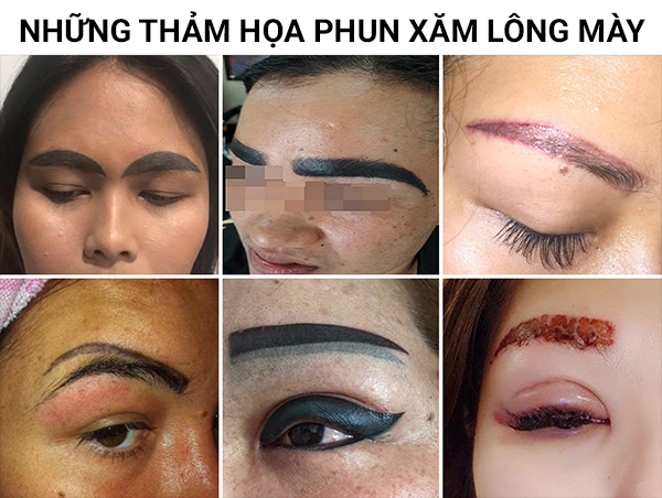 sua-chan-may-hong-gia-bao-nhieu-1