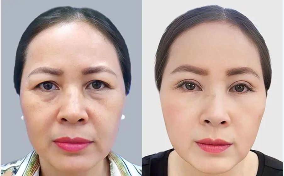 cat-mi-mat-duoi-co-nguy-hiem-khong-2