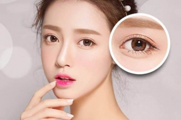 Cắt mí mắt dưới có nguy hiểm không
