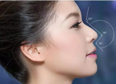 Niềng răng có nâng mũi được không
