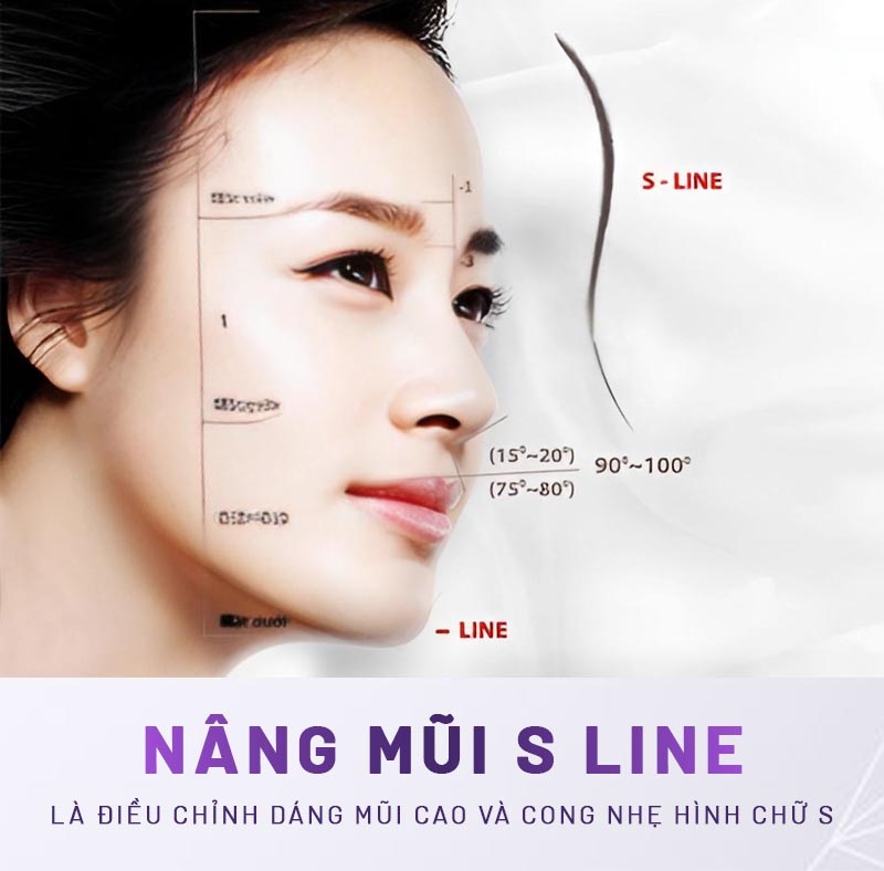 tai-sao-nang-mui-sline-duoc-nhieu-khach-hang-lua-chon-2_1