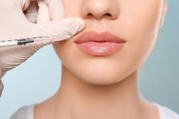 Tiêm filler môi có gây hại ? Những điều bạn cần biết trước khi làm đẹp