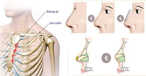 nhung-loi-the-cua-nang-mui-sun-suon-1