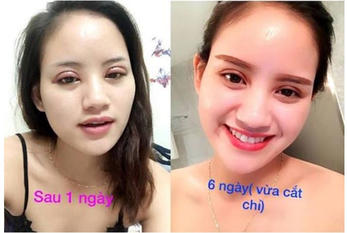 cat-mi-mat-bi-sung-tham-nhieu-ngay-co-sao-khong-1