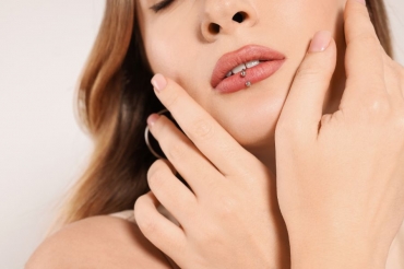 Sẹo lồi ở môi có tự lặn theo thời gian được không?