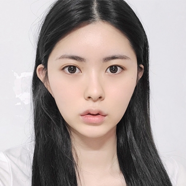 Trẻ hóa mí mắt dưới: vì sao 80% khách hàng Hàn Quốc đều chọn cắt da mí dưới cung mày?