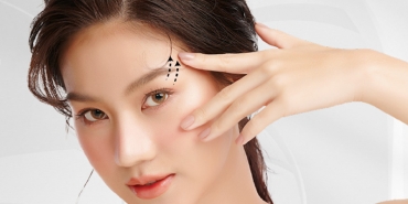 Treo mí mắt bằng chỉ có hiệu quả không