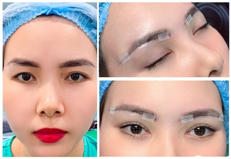 treo-mi-mat-bang-chi-co-hieu-qua-khong-1