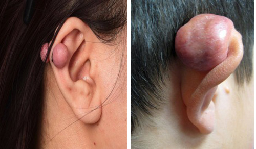 tri-seo-loi-dai-tai-co-an-toan-khong-1