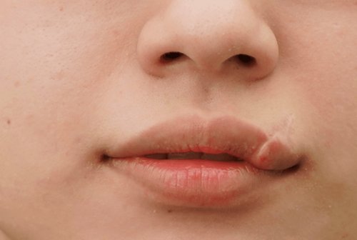 xoa-seo-moi-co-gap-bien-chung-khong-1